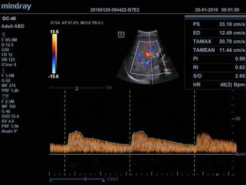 Аппарат ультразвуковой диагностический DC-40 - 414 700 руб.