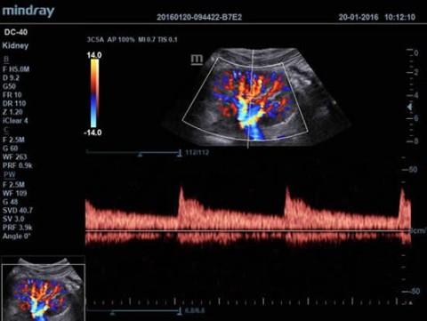 Аппарат ультразвуковой диагностический DC-40 - 414 700 руб.