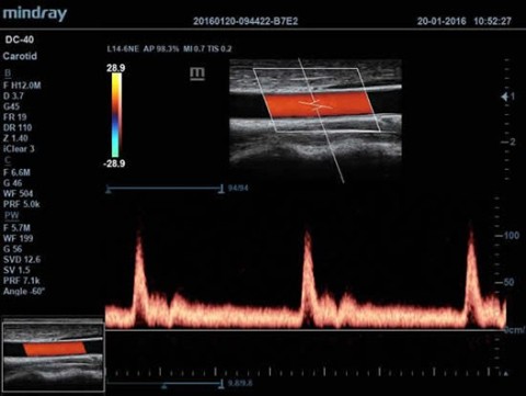 Аппарат ультразвуковой диагностический DC-40 - 414 700 руб.