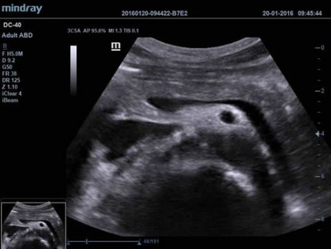 Аппарат ультразвуковой диагностический DC-40 - 414 700 руб.