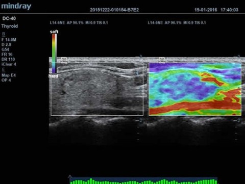 Аппарат ультразвуковой диагностический DC-40 - 414 700 руб.