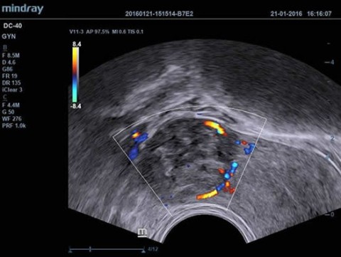 Аппарат ультразвуковой диагностический DC-40 - 414 700 руб.