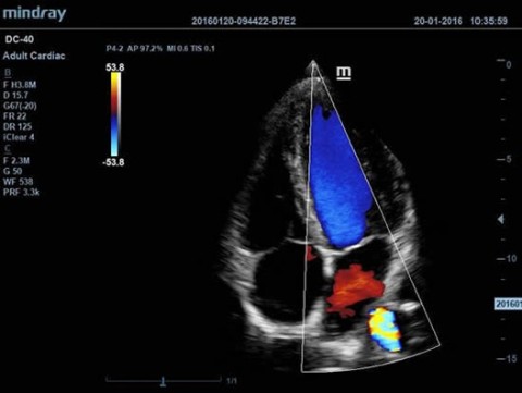 Аппарат ультразвуковой диагностический DC-40 - 414 700 руб.