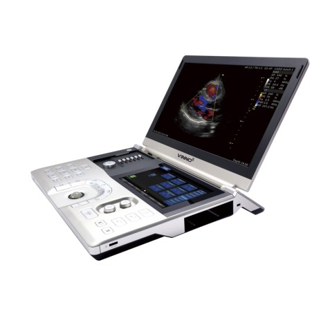 Портативный УЗИ сканер VINNO 5 - 0 руб.