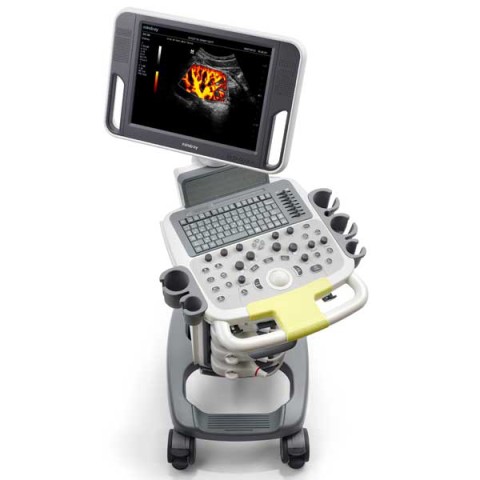 УЗИ сканер Mindray DC-N3 - 331 700 руб.