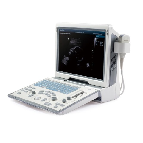 УЗИ аппарат Mindray DP-50 - 250 000 руб.