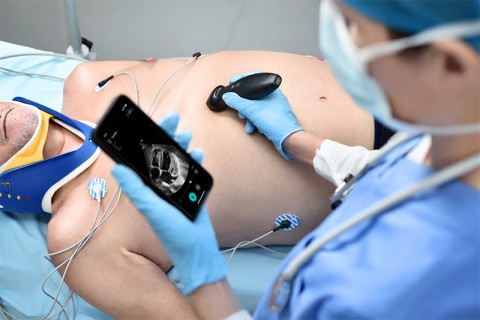 УЗИ сканер Mindray TE Air i3P - 349 000 руб.