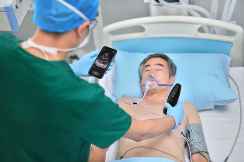 УЗИ сканер Mindray TE Air i3P - 349 000 руб.