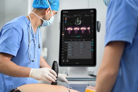 УЗИ сканер Mindray TE Air i3P - 349 000 руб.