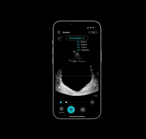 УЗИ сканер Mindray TE Air i3P - 349 000 руб.