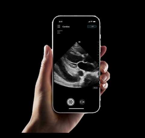 УЗИ сканер Mindray TE Air i3P - 349 000 руб.