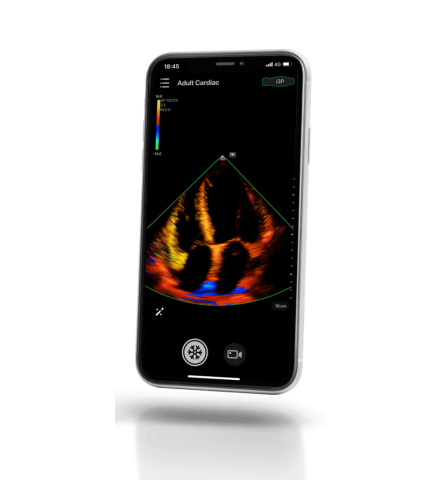 УЗИ сканер Mindray TE Air i3P - 349 000 руб.