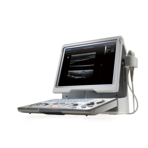 УЗИ аппарат Mindray DP-50 Color - 376 000 руб.